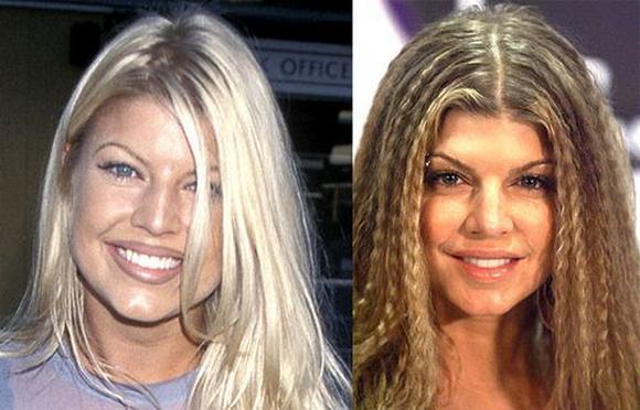 fergie
