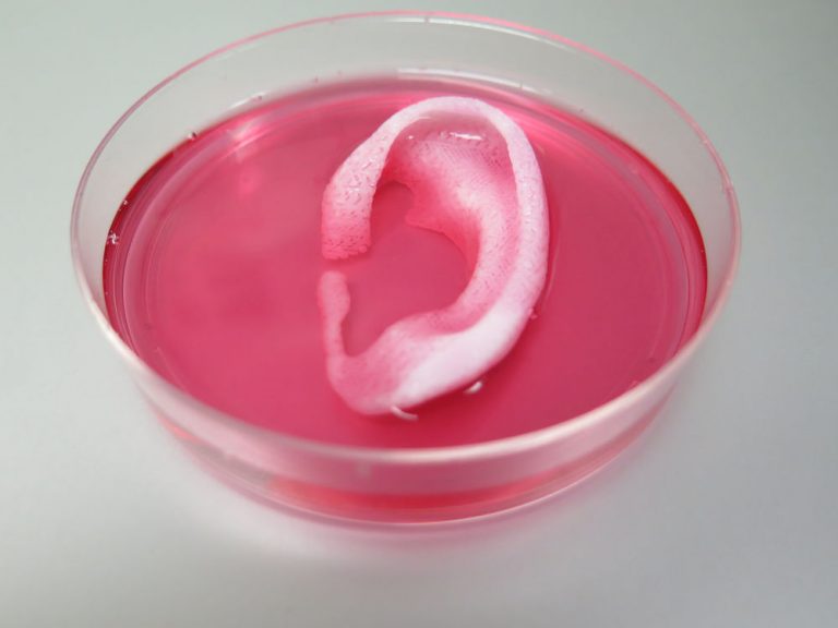 3D bio-tlačiareň vytvára kosti, svaly a chrupavky pre toto ucho