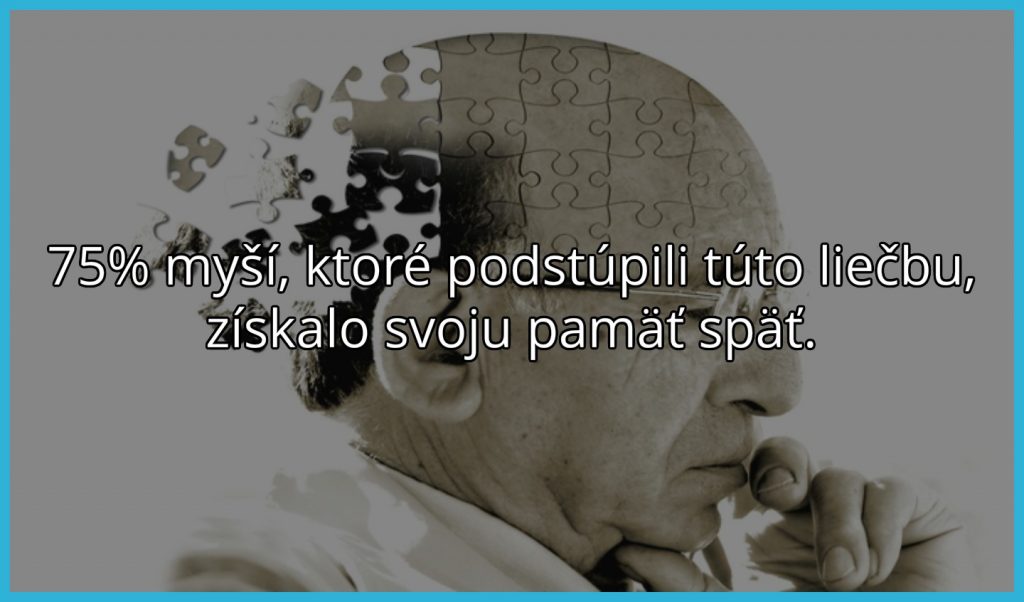 Alzheimerova choroba