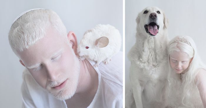 Fotografický projekt, ktorý zachytáva krásu a čistotu ľudí s albinizmom