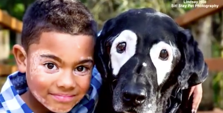 Malý chlapec s kožnou chorobou vitiligo našiel svoju spriaznenú dušu