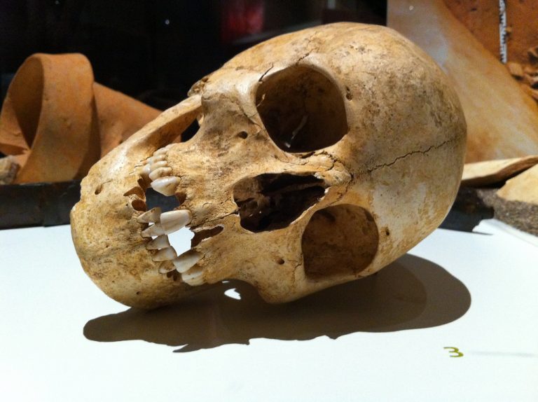 Prečo si ľudia v dávnych civilizáciách robili diery do lebiek?