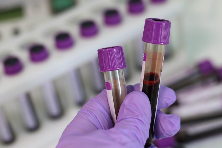 Krvný test, ktorý predpovedá čas vašej smrti? Dnes už je možné takmer všetko