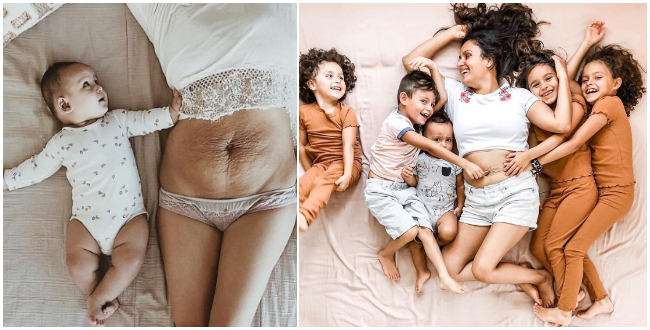 Matka 5 deti zdieľa fotografie svojho tela a povzbudzuje aj ostatné matky, aby sa za svoje jazvy nehanbili