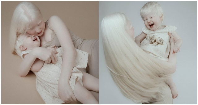 Sestry albínky sa narodili 12 rokov po sebe a získavajú si srdcia ľudí svojimi krásnymi fotografiami