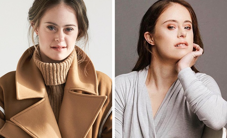 Má Downov syndróm, no jej úspešnú športovú ani modelingovú kariéru to nezastavilo a je veľkou inšpiráciou