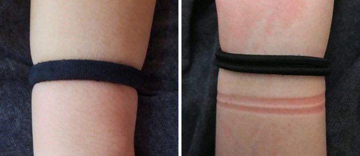 3 dôvody prečo by ste nemali nosiť vlasové gumičky na zápästí
