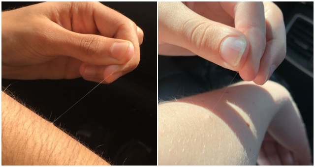 Prečo si niekedy nájdete jeden či dva chĺpky na tele s absurdnou dĺžkou? Takých ľudí je veľa