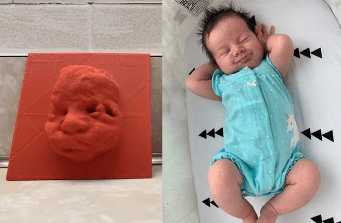 Nevidiaca matka mohla „vidieť“ svoje dieťa vďaka 3D tlačenému ultrazvuku a nie je sama