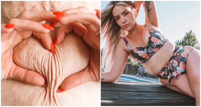 Porodila 4 deti a snaží sa ukázať všetkým ženám, že sa nemusia hanbiť za svoje telo