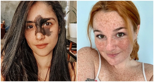 Prirodzenosť je cennejšia ako umelá krása a títo ľudia ukazujú, že sa netreba hanbiť za svoje odlišnosti