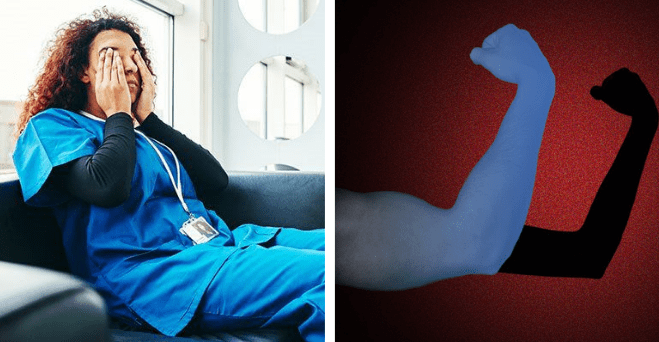 Čo pomáha predchádzať spáleniu od slnka a čo vás podľa výskumov môže presvedčiť, že vyzeráte lepšie #zaujimavosti