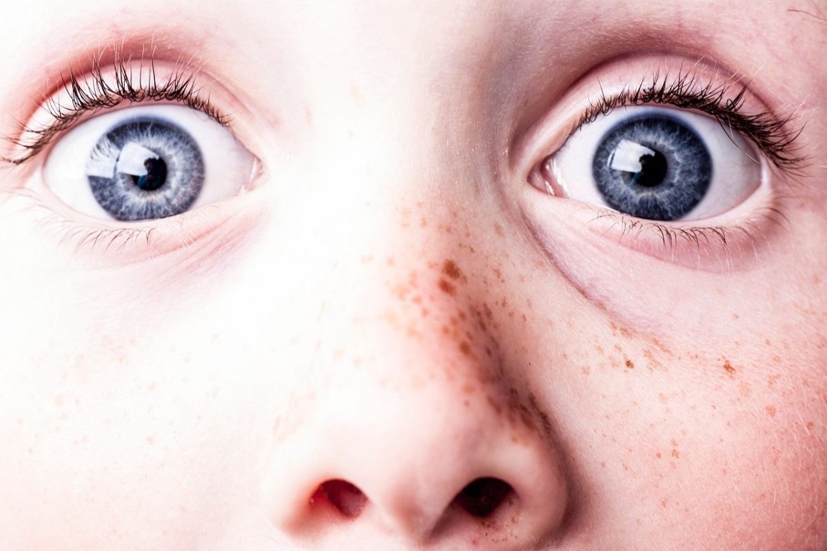 suprised, blue eyes, freckles