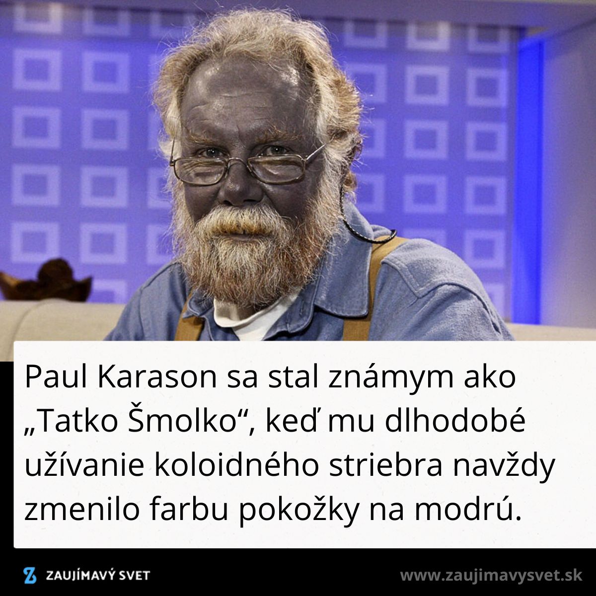 Muž s modrou pokožkou sedí v televíznom štúdiu. Výsledok dlhodobého užívania koloidného striebra.