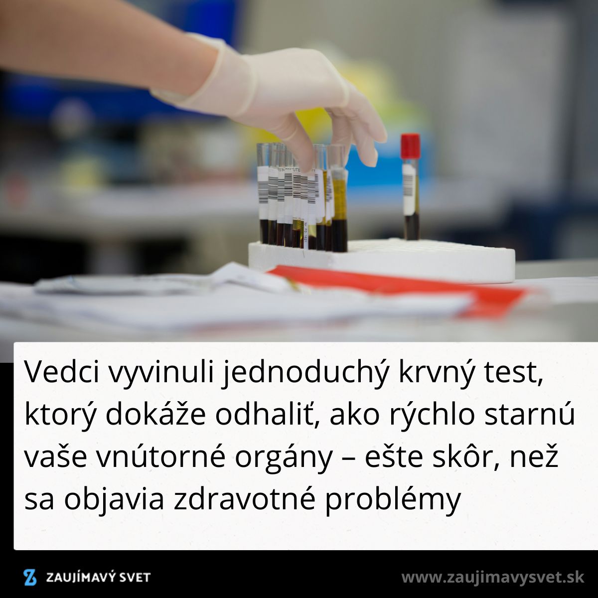 Vedec s rukavicou drží skúmavky s krvnými vzorkami v laboratóriu.