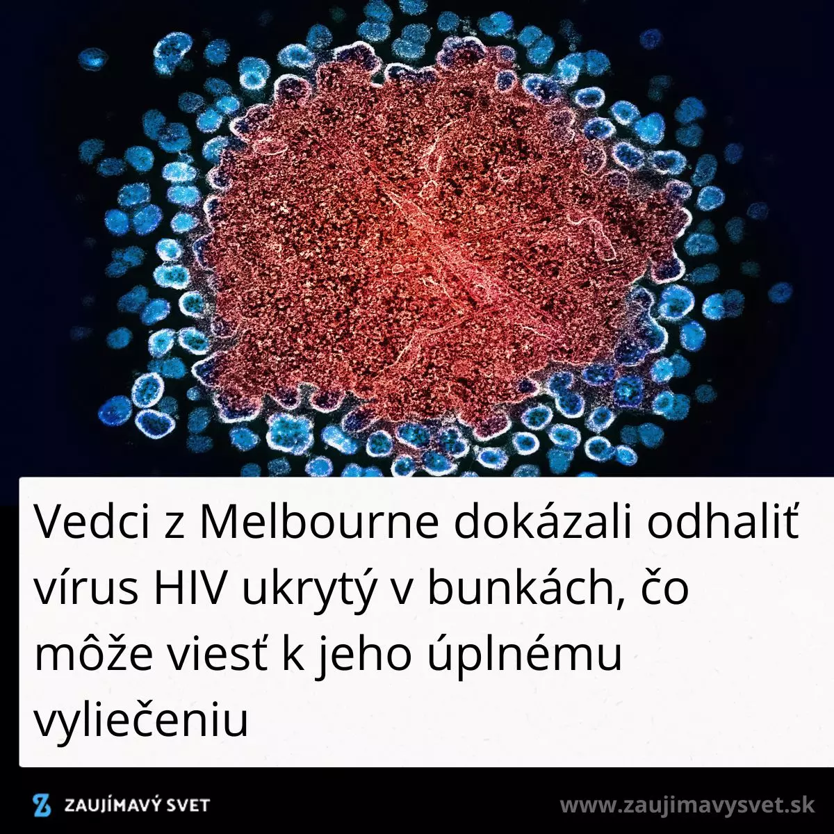 Vírus HIV pod mikroskopom, vedecký pokrok z Melbourne v odhalení skrytého vírusu v bunkách.