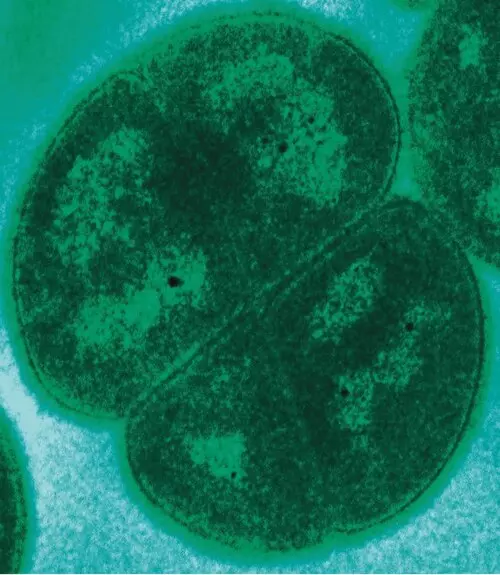 Zelený mikroskopický obrázok baktérie Deinococcus radiodurans, známej svojou odolnosťou voči radiácii.