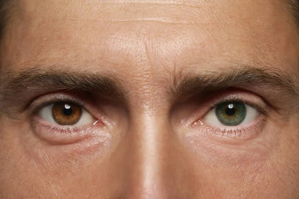 Detailný záber na heterochrómne oči: jedno hnedé aj jedno modré oko.